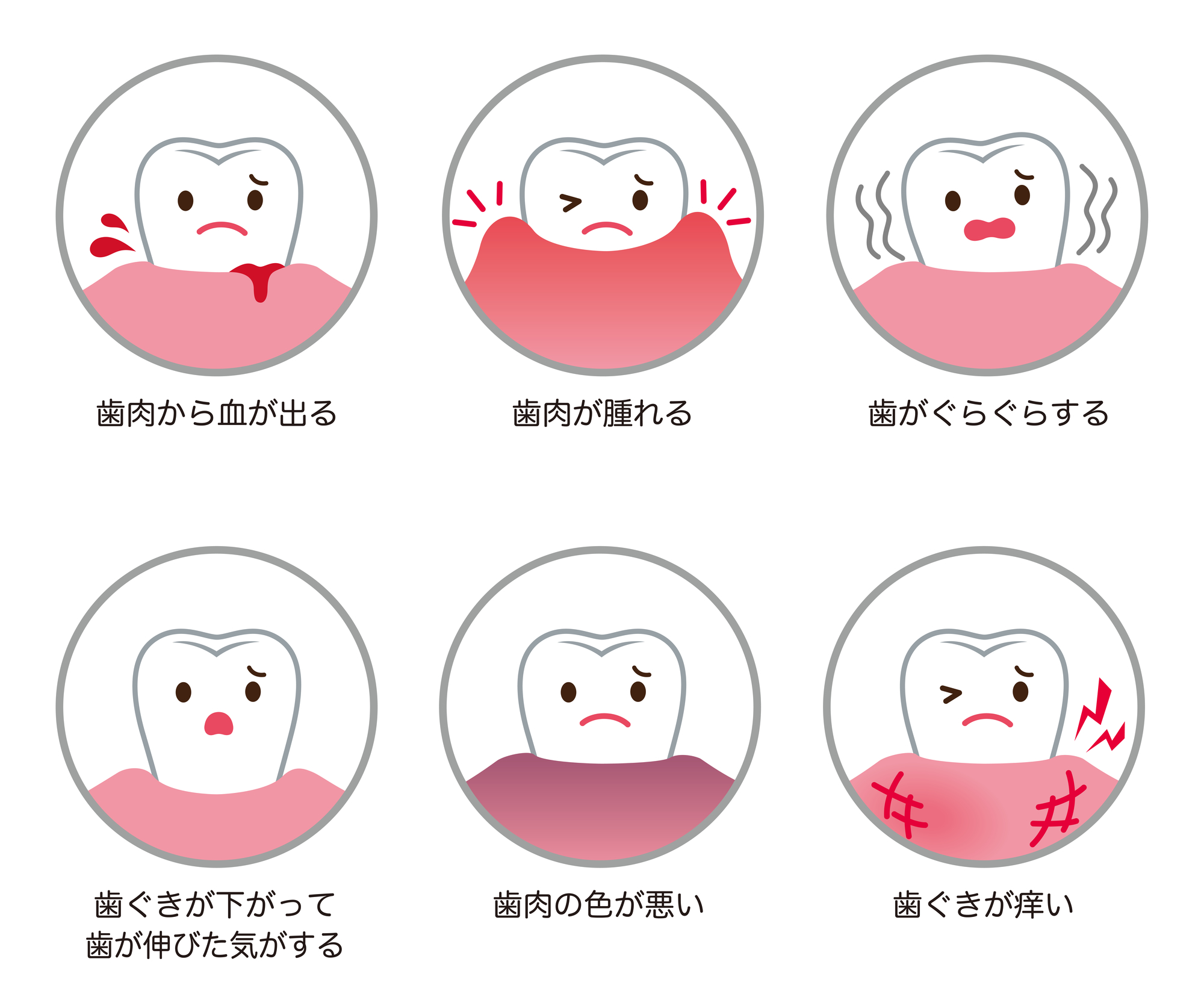 歯周病の症状